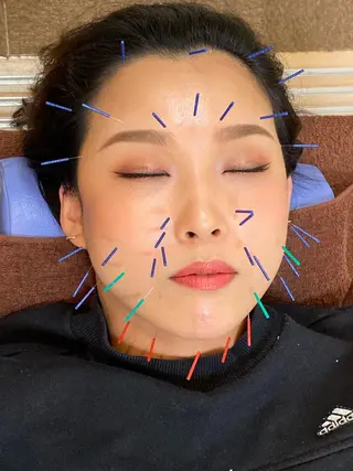 鍼灸整体院　蕾所属・美容鍼 蕾【谷町六丁目】のエステ・リラクイメージ