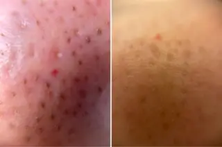 DeI'm豊岡店所属・岸本 みゆ妃のエステ・リラクイメージ