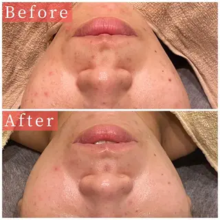 ハーブピーリング専門 muro.のエステ・リラクイメージ