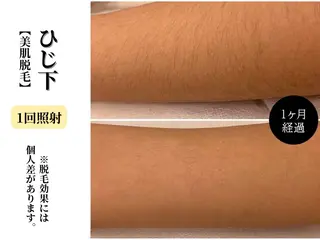 Belle White所属・本格痩身＊肌質改善＊ BelleWhiteのエステ・リラクイメージ