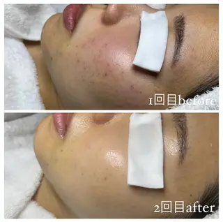 肌改善・リンパサロン CoCoxiaのエステ・リラクイメージ