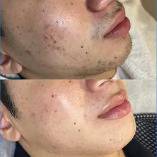 メンズ BEBROW 堀江の眉毛・アイブロウイメージ