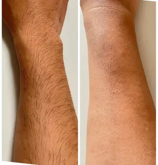 メンズ メンズ脱毛&エステ Passion所属・メンズ脱毛サロン Passionのエステ・リラクイメージ