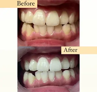 ホワイトニングサロン nybeのその他イメージ