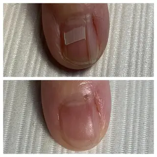 ネイル 大橋 愛のエステ・リラクイメージ