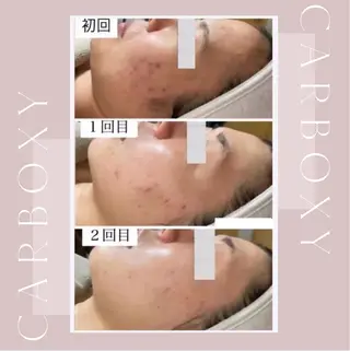 艶肌ワックス ALLY.のエステ・リラクイメージ