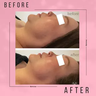 南森町・肌質改善 BELMIMARのエステ・リラクイメージ