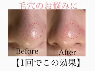 六本木脱毛andS 店長Sachiのエステ・リラクイメージ