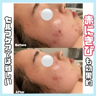 オールハンド専門🤍 kasumiのエステ・リラクイメージ