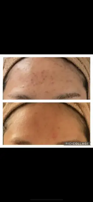 🥀エステティック レイビス横浜 永🥀のエステ・リラクイメージ