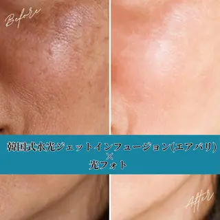 美BARI新宿店 RINAのエステ・リラクイメージ