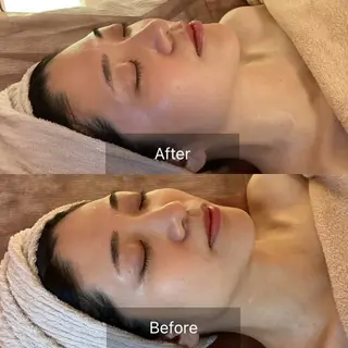 美肌エイジングケアサロンIB所属・ＩＢ 内藤のエステ・リラクイメージ