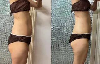 エイジングケアサロンBIOEL所属・肌質改善BIOELプ ラズマ/ラミピールのエステ・リラクイメージ