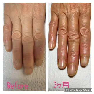 ネイル 荒井 恵のネイルデザイン