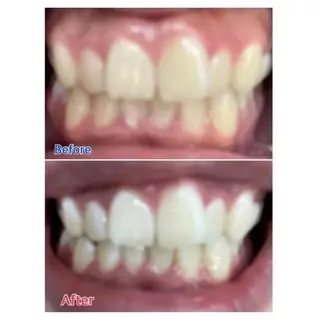 M渋谷店所属・M渋谷 ホワイトニングのエステ・リラクイメージ