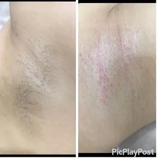 産後/ツヤ肌/子連れ /保育士在籍サロンのエステ・リラクイメージ