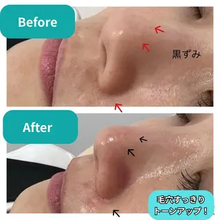 TWINKLE上尾店 Shimadaのエステ・リラクイメージ