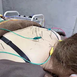 Spring鍼灸院所属・Spring鍼灸院 ✨首肩こり、腰痛に！のエステ・リラクイメージ