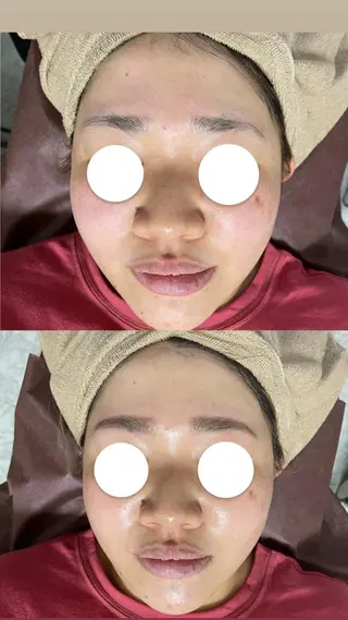 メンズ Epina 千葉店 【エピナ】のエステ・リラクイメージ