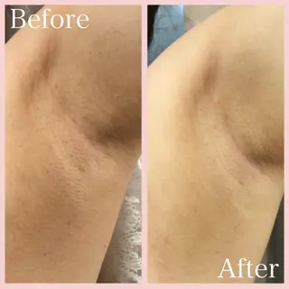 茅ヶ崎Queen エステ/脱毛/リラクのエステ・リラクイメージ