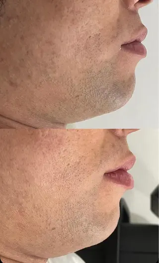 セルフエステエンリケ明石大久保店所属・夕希 毛穴と脱毛特化サロンのエステ・リラクイメージ