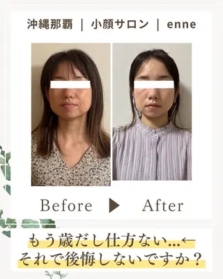 小顔サロンenne所属・小顔サロンenne 【エンネ】のその他イメージ