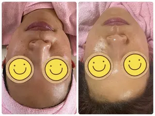 Salon Rion所属・Rion 野々村のエステ・リラクイメージ