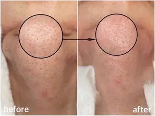 韓国肌管理 【毛穴専科】のエステ・リラクイメージ