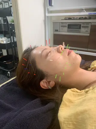 小顔矯正・美容鍼 FLOW鍼灸整体院のエステ・リラクイメージ