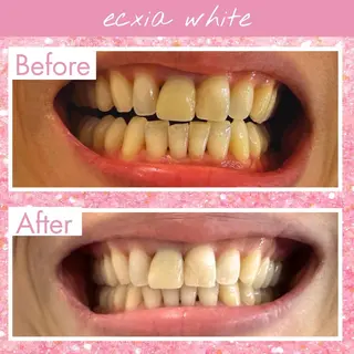 セルフホワイトニング エクシア札幌大通り店のその他イメージ