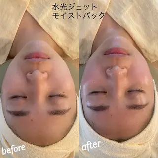 うなじ脱毛/美肌脱毛 LABELのエステ・リラクイメージ