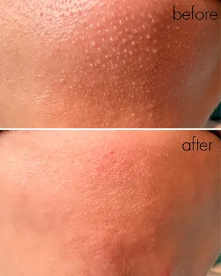 蝶式糸除毛専門salon aco所属・糸除毛専門salon acoのエステ・リラクイメージ