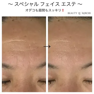 ビューティー ミロワールのエステ・リラクイメージ