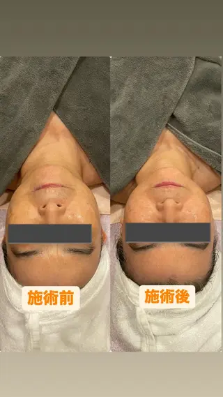 丸の内ヒルズ 鈴木麻瑚のエステ・リラクイメージ