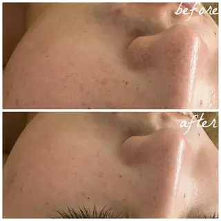 メンズ メナード岐阜茜部 杉浦のエステ・リラクイメージ