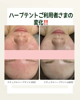 🍋レモンケーキ🍋所属・Lemon cakeのエステ・リラクイメージ