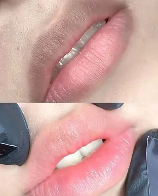 脱毛×肌管理サロン ルネルのエステ・リラクイメージ