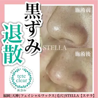 ドライヘッドスパ＆ リンパ専門店　ステラのエステ・リラクイメージ