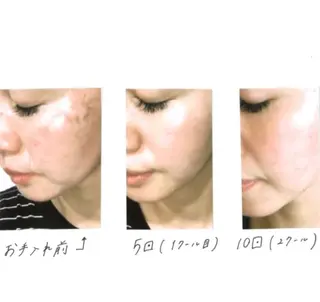 メンズ men's脱毛 memoryのエステ・リラクイメージ