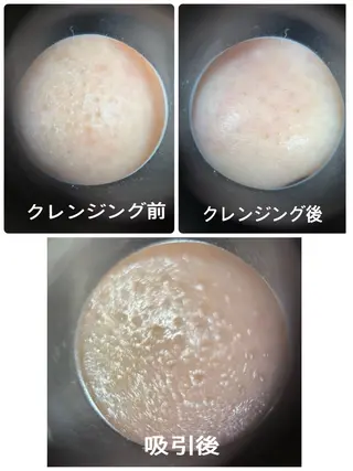 メナードフェイシャルサロン大曽根店所属・長友 一代のエステ・リラクイメージ