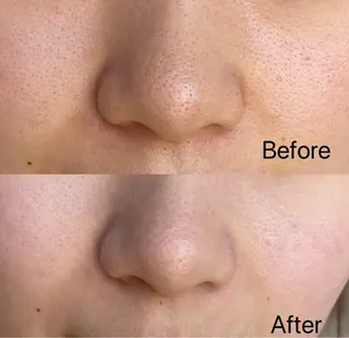 はせがわ せりなのマツエク・マツパデザイン