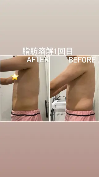 アルカンジュ~archange~所属・痩身/毛穴洗浄/脱毛 アルカンジュのエステ・リラクイメージ