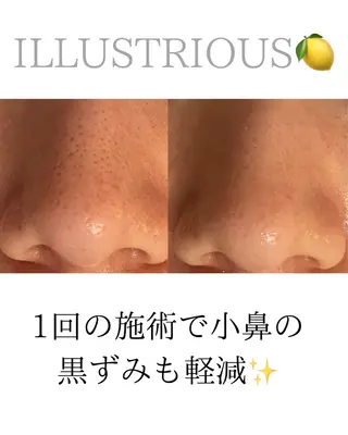 田中For..天王寺 肌質改善/よもぎ蒸しのエステ・リラクイメージ