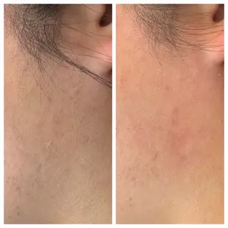 chou. chouのエステ・リラクイメージ