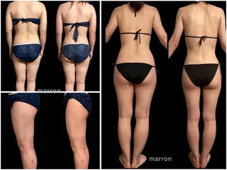 marron所属・痩身ハイパーナイフ ララピールリアボーテのエステ・リラクイメージ