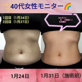 メンズ 武 藤のエステ・リラクイメージ