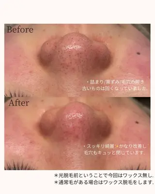 毛穴と脱毛のお店 "Lea" 壷林のエステ・リラクイメージ