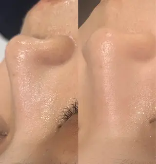 メンズ レセラ銀座所属・レセラ 銀座のエステ・リラクイメージ