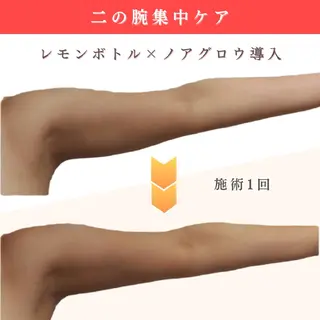 痩身小顔専門 アマテ ビューティー.Nのエステ・リラクイメージ