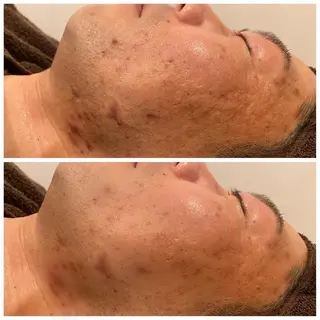 SALON BioBioのエステ・リラクイメージ